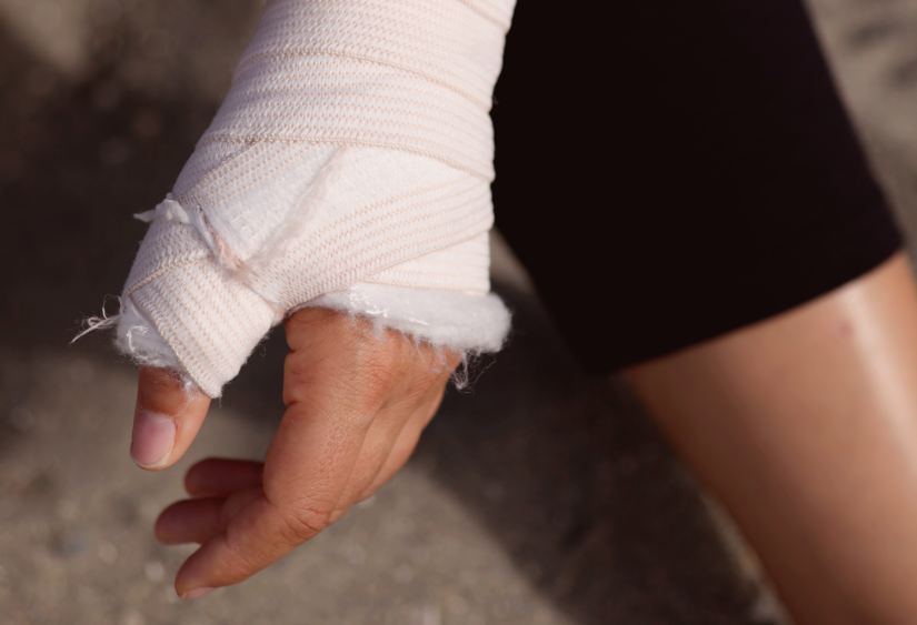 Broken hand tools: a close up of a woman's cast around her hand and wrist
