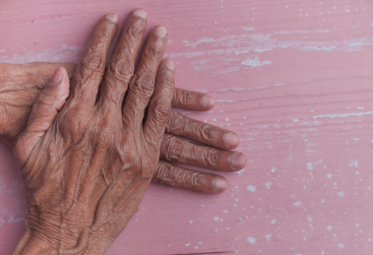 A Closer Look at How Many Arthritis Are There: older woman's hands neatly folded on a pink table