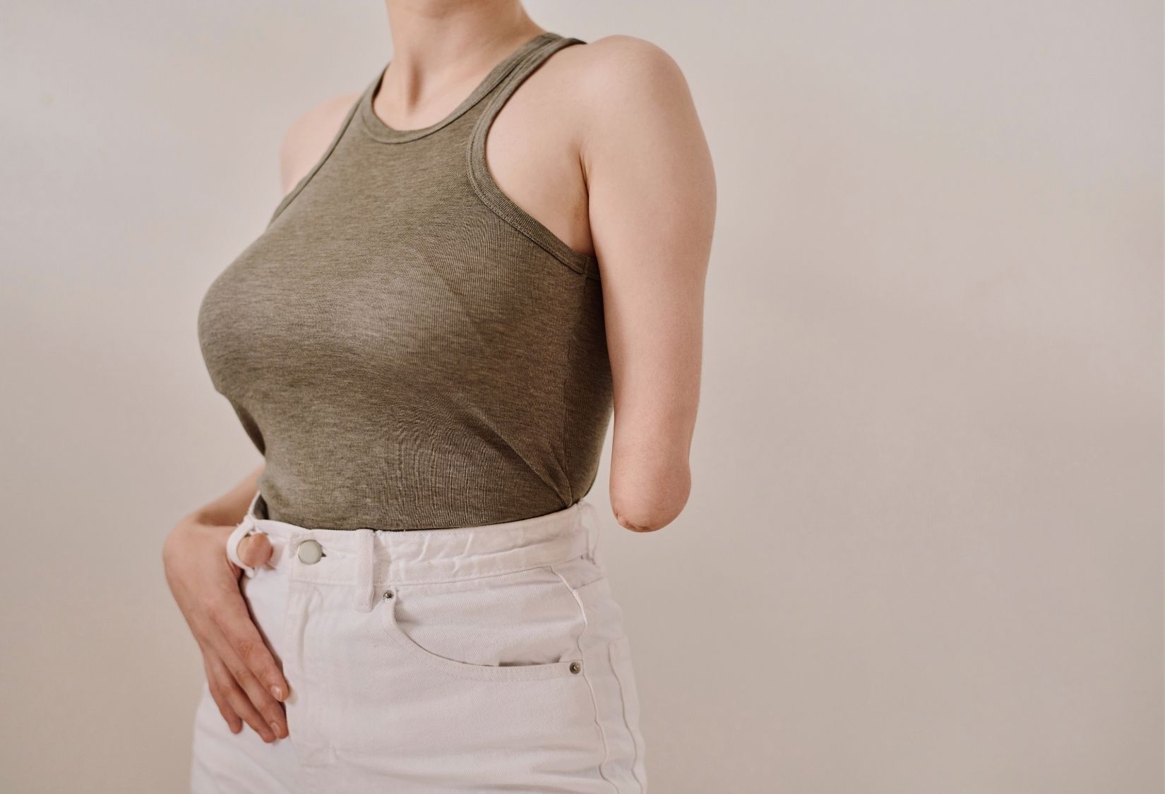 Finding the Best Bras for Amputees: Model with a limb difference wearing white pants and a green top, representing style and confidence for women seeking amputee-friendly clothing options.