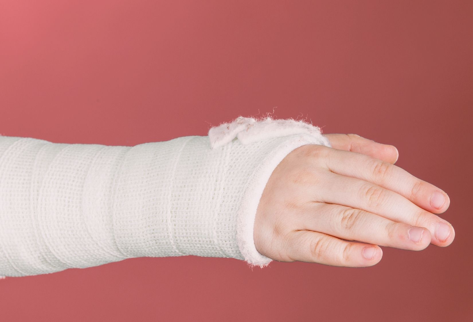 Recovery from a fractured wrist: A close-up of a person's hand and forearm wrapped in a white cast against a red background.