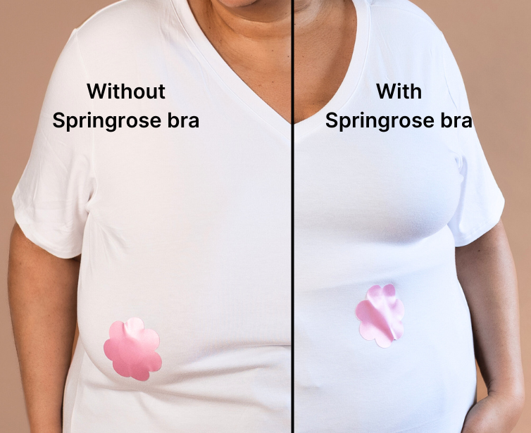 Side by side image showing the supportive nature of the Springrose velcro adaptive bra